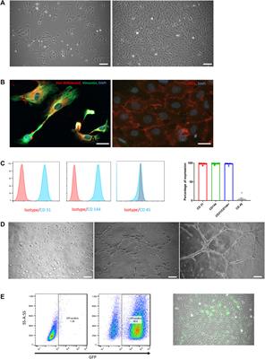 Bio-Engineering of Pre-Vascularized Islet Organoids for the Treatment of Type 1 Diabetes